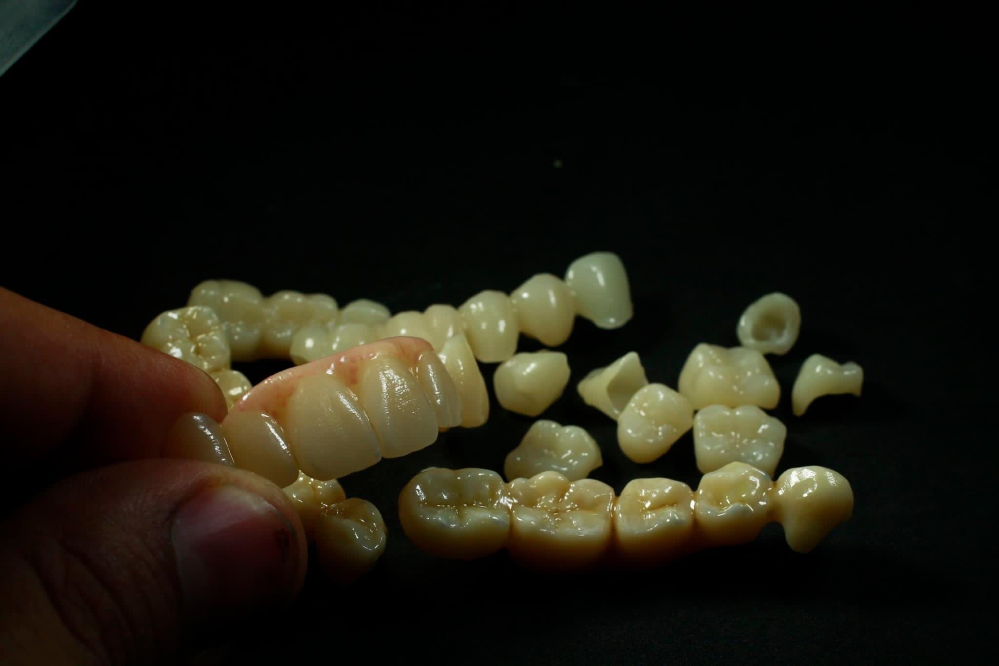Diş Laboratuvarı Malzemesi Porselen Tozu