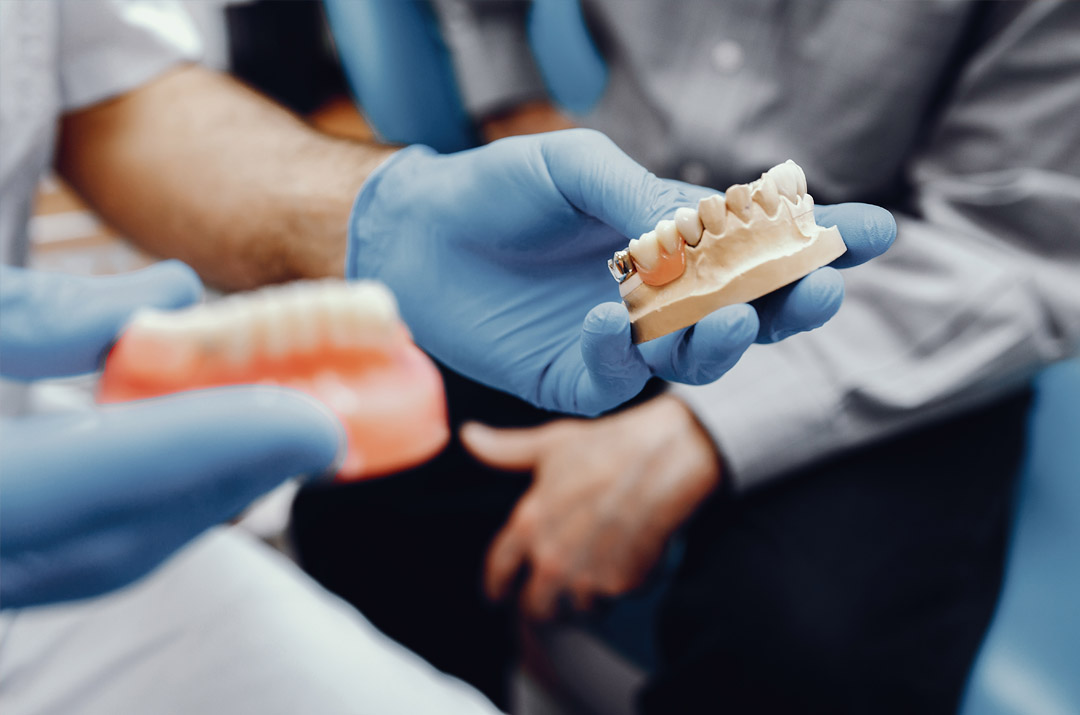 Diş restorasyonu kullanımı için diş zirkonya bloğu