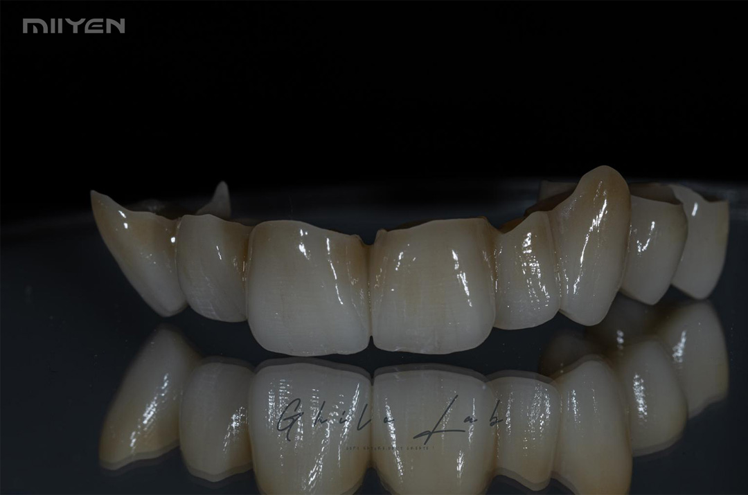 Diş için MIIYEN zirkonya 3D Pro
