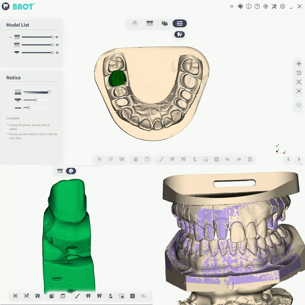 Dental 3D Tarayıcı Makinesi Alt Çene Taraması