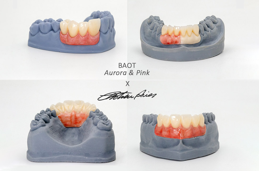 BAOT Aurora Dental Leke Sır İpuçları