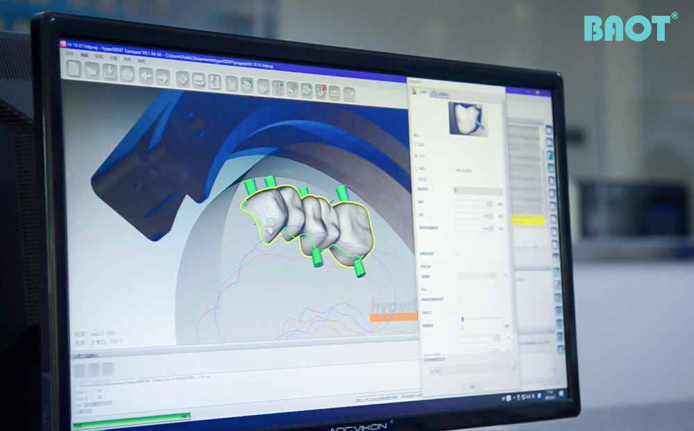 Dijital Diş Hekimliğinin Geleceğinde Zirkonyum Blokların Rolü